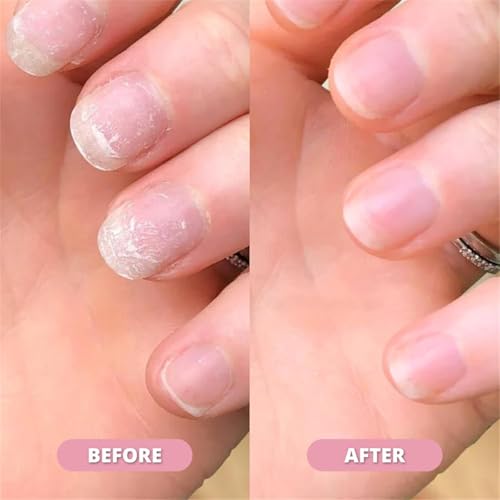 Nail ππ«π¨π°ππ‘ Pen, ππππ¦ πππ₯π₯ Nail ππ«π¨π°ππ‘ Pen, Cuticle Oil for Nails - Strengthen Brittle Nails, Promote Fast-growth, Portable Pen for Healthy NailS (3pcs)