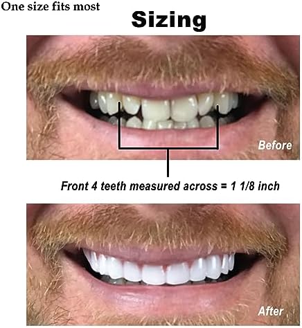 Instant Smile Comfort Fit Flex - Bright Shade - Upper Veneer Cosmetic Teeth