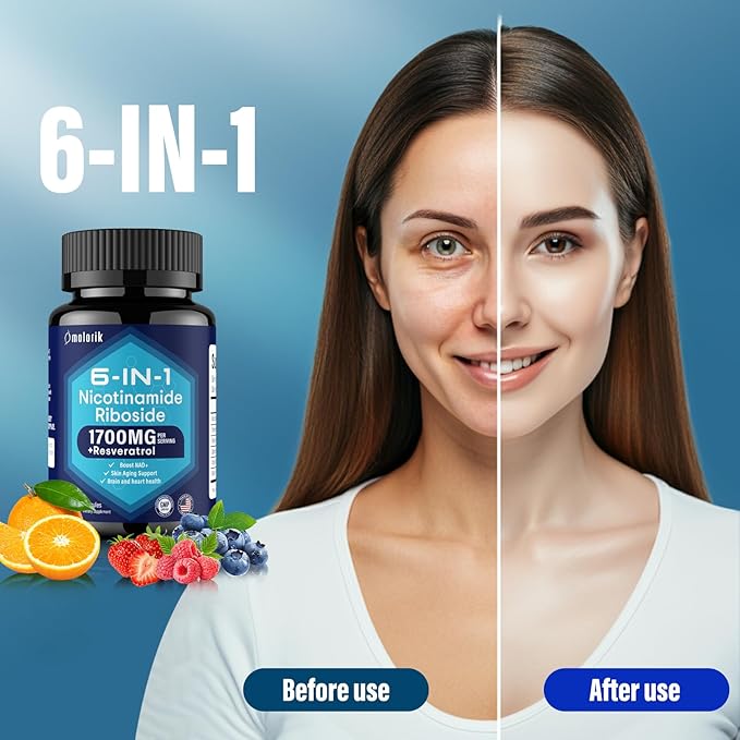 NAD+ Supplement, Nicotinamide Riboside 1700mg, with Trimethylglycine, Trans-Resveratrol, Vitamin C, Niacinm(B3), Supports Anti-Aging, Cell Repair, Healthy Skin - Pink 34