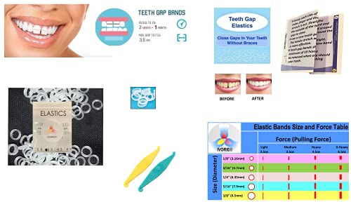 IVORIE Cosmetic Elastic Rubber Bands Braces Gap Alignment 60 Pack and Placers for Gap Closing (Clear 1/4" X-Heavy 6.5 oz)