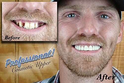 Professional Cosmetic Upper - New from Instant Smile! Hand Crafted Detail, Custom fit at Home! Works Best in Medium to Large Sized Mouths.