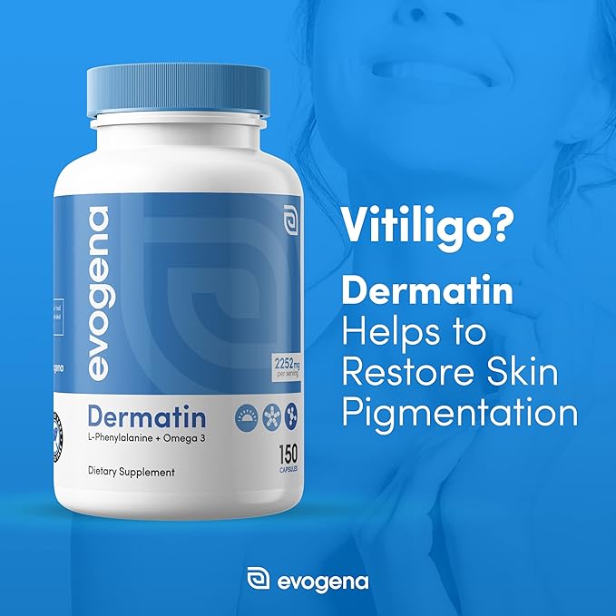 Effective Vitiligo Treatment That Can be Used with a Vitiligo Repigmentation Cream - Say Goodbye to White Spots on Skin - These Vitiligo Pills include Vitamins Such As Vitamin D and Vitamin B6
