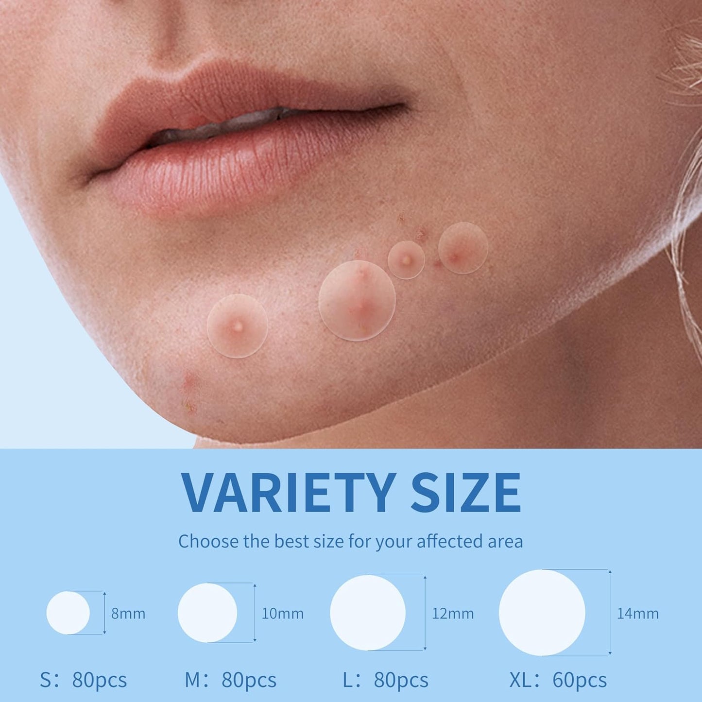 Large Hydrocolloid Acne Patches | 400 Count | Effective Zit Treatment