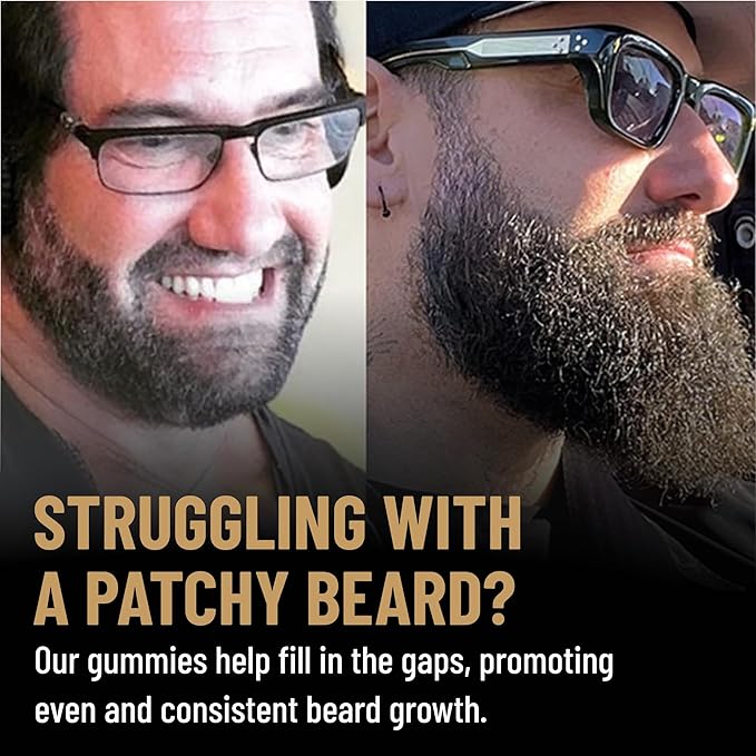 Derm Dude Beard Growth Gummies for Men | Packed With Biotin 10K MCG for Healthier, Thicker, Fuller & Stronger Facial Hair | Restore Hair Breakage & Thinning | Berry Flavored | 60 Gummies 30-Day Supply