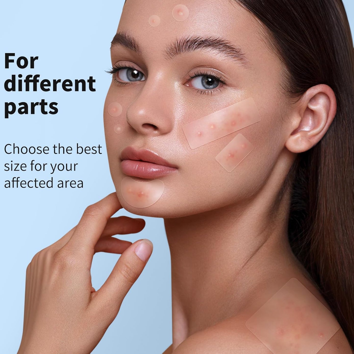 Hydrocolloid Pimple Patches | 510 Count Acne Spot Stickers with Salicylic Acid & Tea Tree Oil