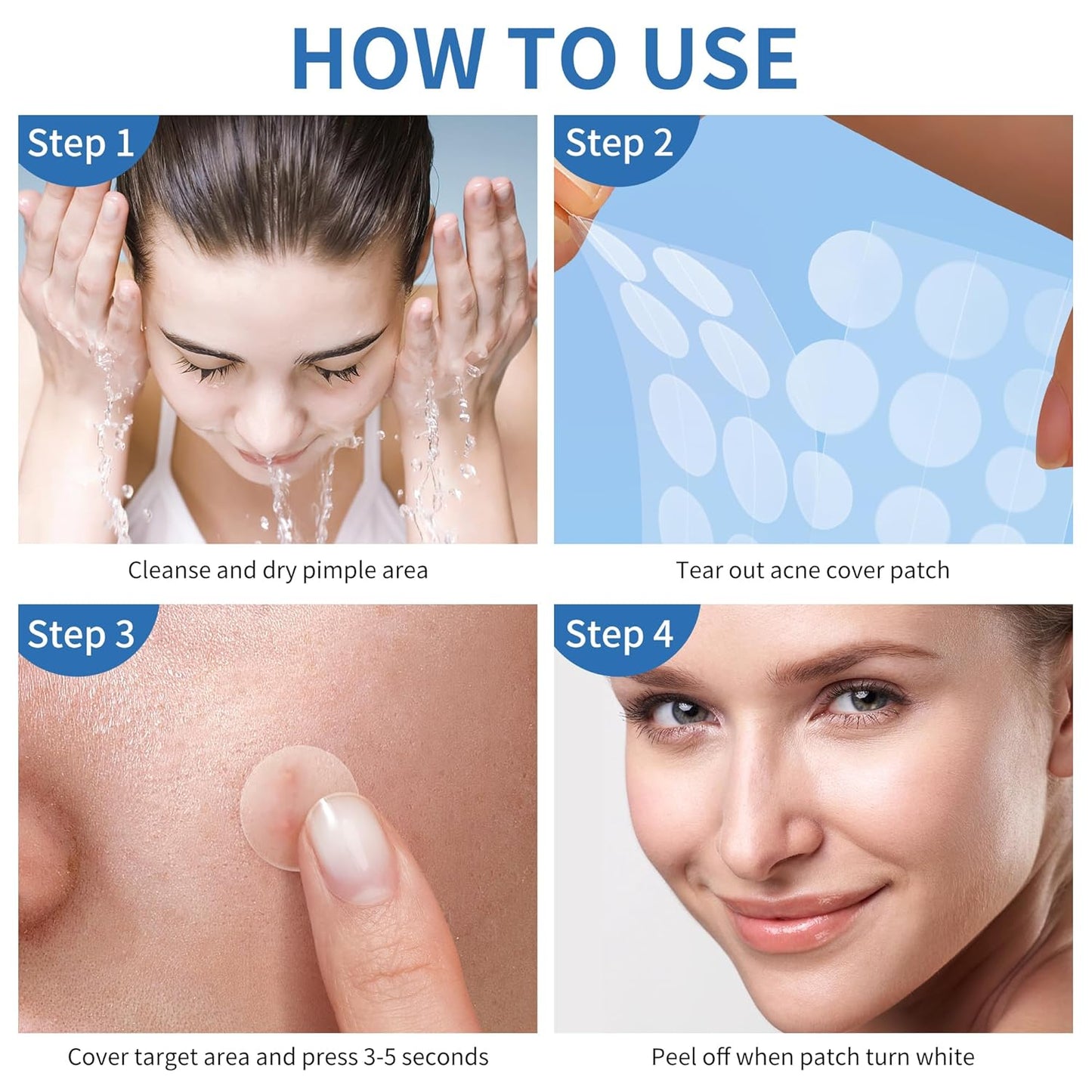 Large Hydrocolloid Acne Pimple Patches | 142 Count | 6 Sizes for Face & Body
